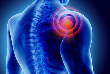shoulder dislocation treatment