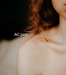 The Broken Collarbone (clavicle)